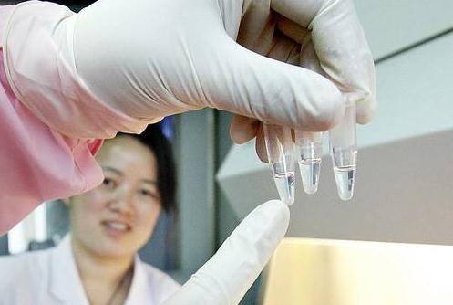 北京怎么做DNA亲子鉴定